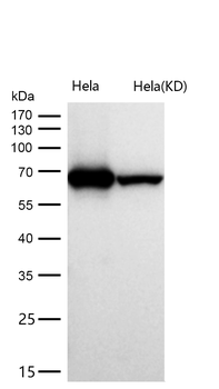 DDX5 Rabbit mAb [KD Validated] Antibody