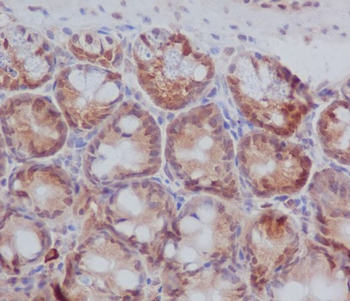 PKC beta 1 Rabbit mAb Antibody