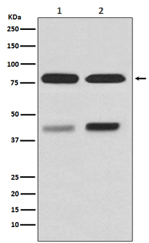 PKC beta 1 Rabbit mAb Antibody