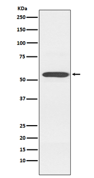 Cytochrome P450 2D6 Rabbit mAb