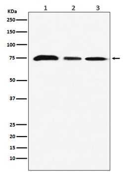 KAT7 / HBO1 / MYST2 Rabbit mAb [KD Validated]