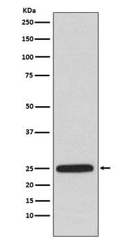 HPRT Rabbit mAb Antibody