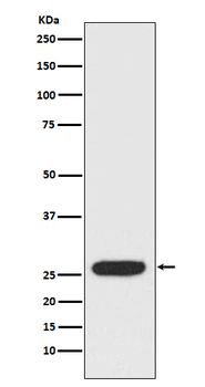StAR Rabbit mAb Antibody