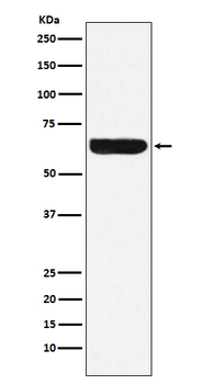 Placental alkaline phosphatase (PLAP) Rabbit mAb Antibody