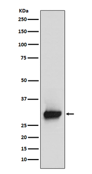 Calretinin Rabbit mAb Antibody