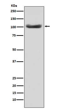 MSH2 Rabbit mAb Antibody