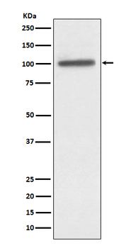 alpha Actinin 4 Rabbit mAb Antibody