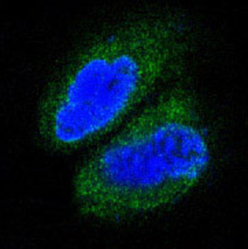 TAK1 Rabbit mAb Antibody