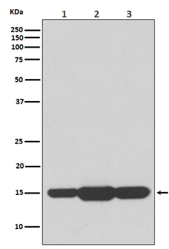 GABARAPL2 Rabbit mAb Antibody