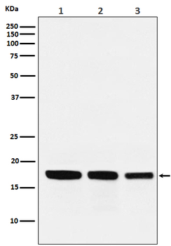 GABARAP Rabbit mAb Antibody