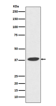 DNA Polymerase beta Rabbit mAb Antibody
