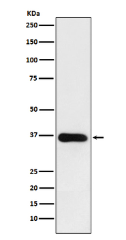 HSD11B1 Rabbit Monoclonal Antibody
