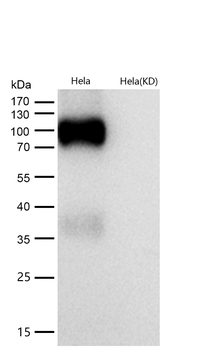 ApoER2 Rabbit mAb [KD Validated] Antibody