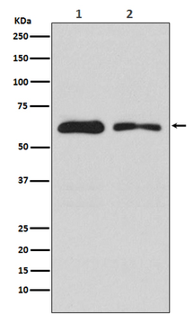 DOPA Decarboxylase Rabbit Monoclonal Antibody