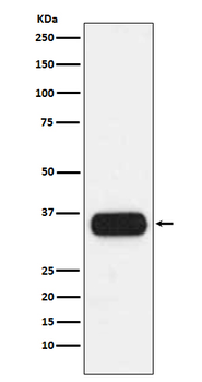 HLA-DQA1 Rabbit mAb Antibody