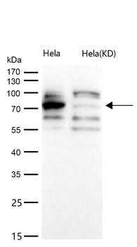 Calpain 2 Rabbit Monoclonal Antibody
