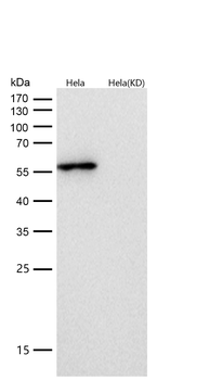 GLUR Rabbit mAb [KD Validated] Antibody