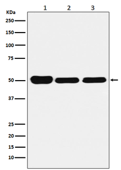 GLUR Rabbit mAb [KD Validated] Antibody