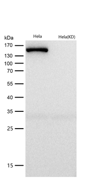 ROCK2 Rabbit mAb  [KD Validated]