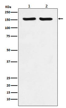 ROCK2 Rabbit mAb  [KD Validated]
