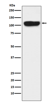 ITCH Rabbit mAb Antibody