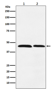 FEN1 Rabbit mAb Antibody