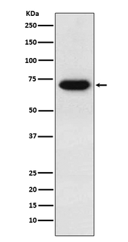 CD39 Rabbit mAb Antibody