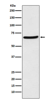 CDT1 Rabbit mAb