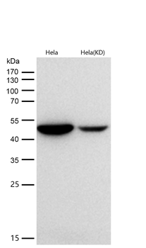 Citrate synthetase Rabbit mAb [KD Validated]