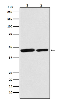 Citrate synthetase Rabbit mAb [KD Validated]
