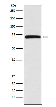 BIRC2 Rabbit Monoclonal Antibody