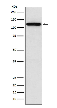 Sortilin Rabbit mAb [KD Validated]