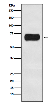 Atg16L1 Rabbit mAb [KD Validated]