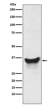 BNIP3L Rabbit mAb Antibody