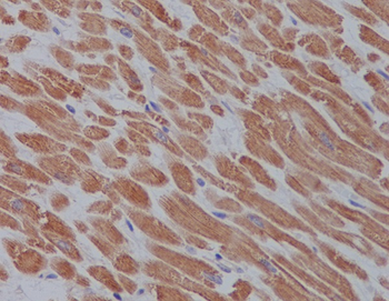 ULK1 Rabbit mAb Antibody