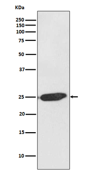 SNAP25 Rabbit mAb Antibody