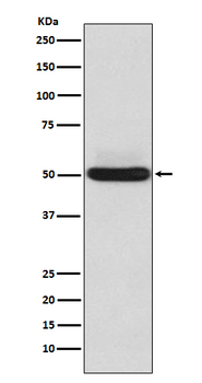 alpha Sarcoglycan Rabbit mAb Antibody