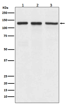 Integrin alpha V Rabbit mAb [KD Validated]
