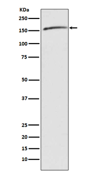 Drosha Rabbit mAb
