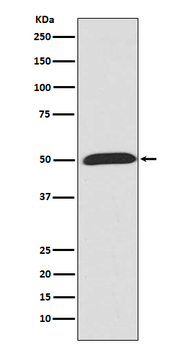 Wnt5a Rabbit mAb [KD Validated]