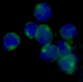 LOX Rabbit mAb Antibody