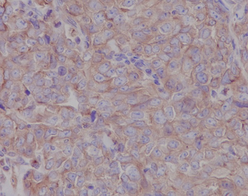 LOX Rabbit mAb