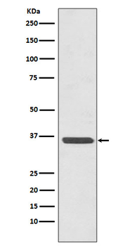 Annexin A2 Rabbit mAb Antibody