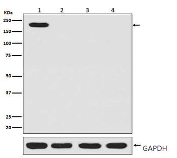 CRISPR-Cas9 SP Rabbit mAb Antibody