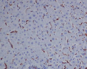 CD163 Rabbit mAb Antibody
