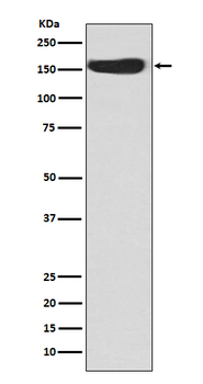 CD163 Rabbit mAb Antibody