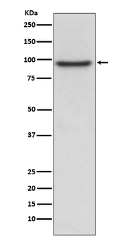 PROX1 Rabbit mAb Antibody