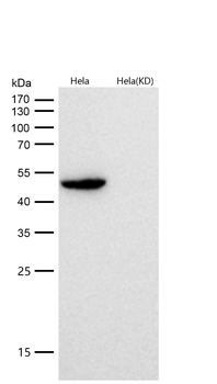 G6PD Rabbit mAb [KD Validated] Antibody