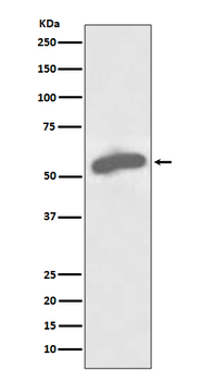 G6PD Rabbit mAb [KD Validated]