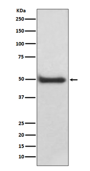 CaMKII delta Rabbit mAb Antibody
